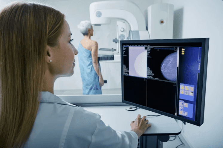 Mamografia é o exame utilizado para rastrear o câncer de mama.